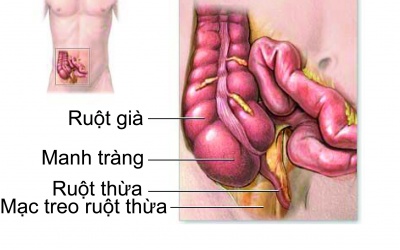 Bạn đã biết các triệu chứng của bệnh viêm ruột thừa? 