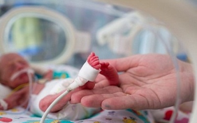 Trẻ sinh non có nguy cơ bị tăng động giảm chú ý cao gấp 4 lần
