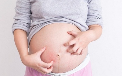 Bà bầu bị ngứa trong thai kỳ: Đâu là nguyên nhân?