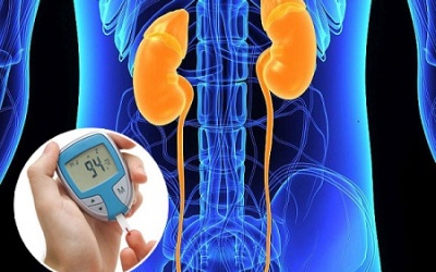 Bệnh thận làm tăng nguy cơ mắc đái tháo đường