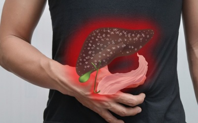 Đau bụng nghiêm trọng có thể là dấu hiệu cảnh báo sỏi mật