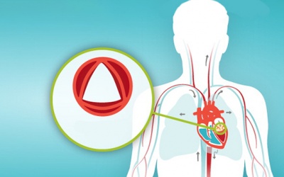 Trắc nghiệm: Bạn biết gì về các bệnh van tim?