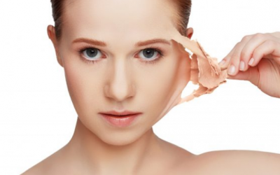 Bác sỹ da liễu mách 5 bước giúp ngăn ngừa khô da trong mùa Đông 