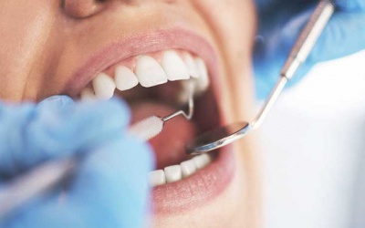 Vi khuẩn gây bệnh răng miệng có thể gây ung thư tuyến tụy?