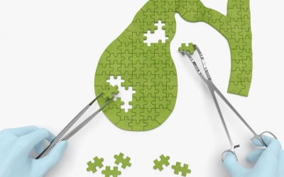 6 lời khuyên giúp phòng ngừa sỏi mật, giữ túi mật khỏe mạnh