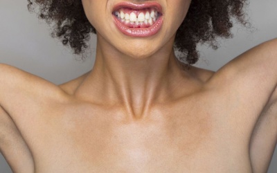 8 lý do khiến mụn trứng cá 'nổi loạn' ở ngực