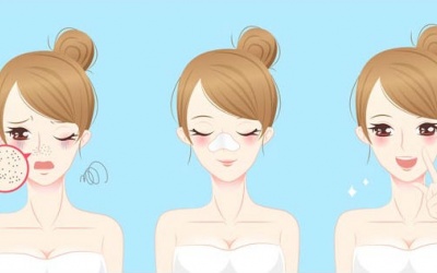 Tự làm mặt nạ tự nhiên trị mụn đầu trắng tại nhà