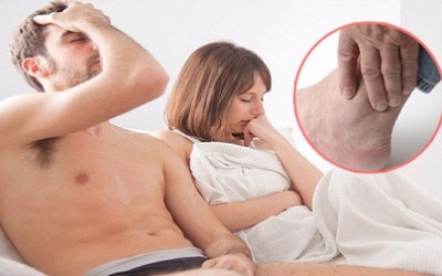 Bệnh gout có thể làm tăng nguy cơ rối loạn cương dương