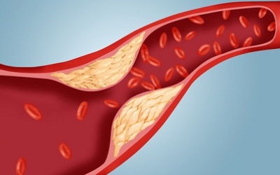 4 thực phẩm tự nhiên giúp làm giảm cholesterol hiệu quả