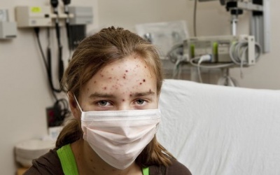 Bệnh thủy đậu có tái phát không?