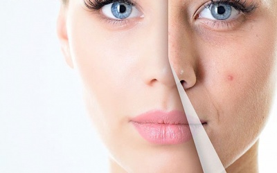 Muốn chống lão hóa da: Đừng quên alpha lipoic acid và selen