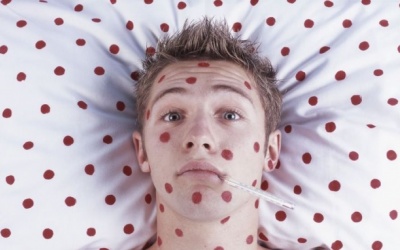 Người lớn bị thủy đậu tránh ăn gì?