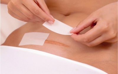 5 dấu hiệu bất thường sau sinh mổ bạn nên lưu ý