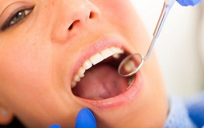 Sức khỏe răng miệng kém làm tăng nguy cơ mắc đái tháo đường