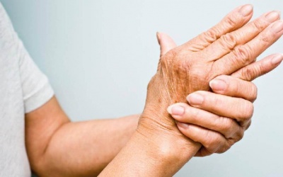 Những cách phòng ngừa bệnh thấp khớp