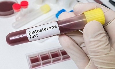 Nên kiểm tra nồng độ testosterone vào thời điểm nào?