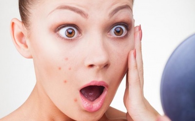 Da bị mụn: Cần chăm sóc thế nào?