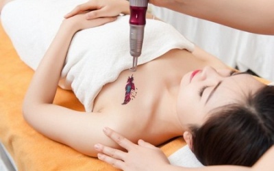 Những điều cần lưu ý khi xóa xăm