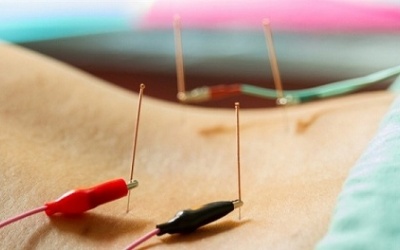 Châm cứu có giúp làm giảm táo bón chức năng mạn tính?