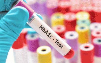 Đường huyết cao nhưng HbA1c thấp vì sao?