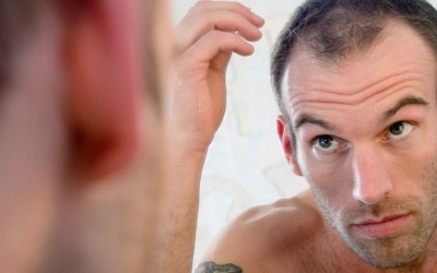 Mẹo ngăn ngừa rụng tóc và hói đầu ở nam giới