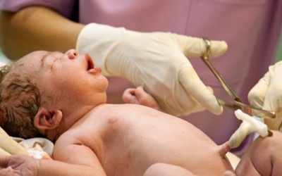 Lưu ý khi thực hiện lưu trữ máu cuống rốn