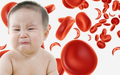 Nên làm gì khi trẻ bị thiếu máu?