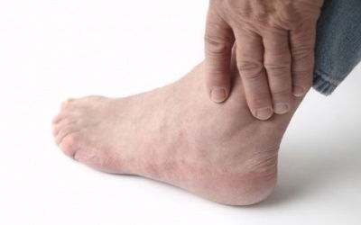 Vì sao vết thương của người bệnh đái tháo đường khó lành?