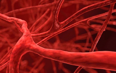 Đọc vị các triệu chứng của bệnh viêm mạch nguy hiểm