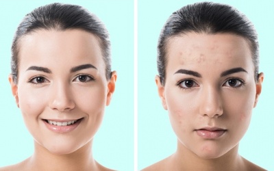 7 sản phẩm làm đẹp bác sỹ khuyên bạn không nên dùng