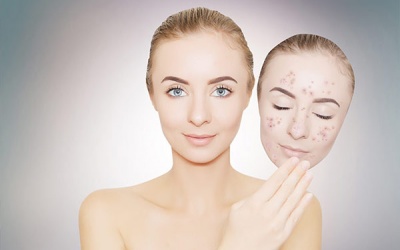 Những cách đơn giản giúp loại bỏ khuyết điểm trên da