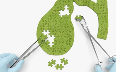 Sau cắt túi mật nên ăn uống, sinh hoạt thế nào?