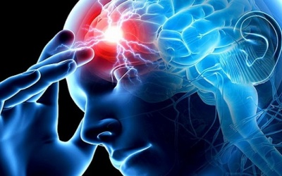 7 cách giảm thiểu nguy cơ đột quỵ