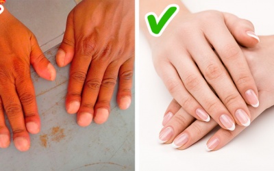 10 dấu hiệu bất thường của cơ thể bạn không nên bỏ qua