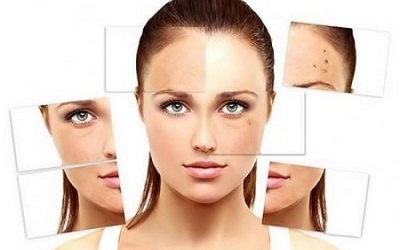 5 dấu hiệu trên da cho thấy chế độ ăn của bạn có vấn đề