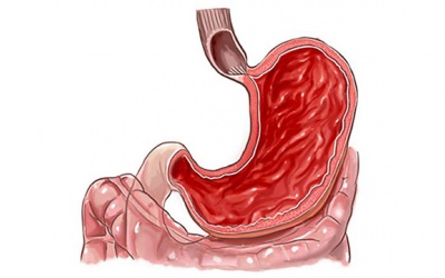 Cách điều trị và ngăn ngừa viêm dạ dày ruột do vi khuẩn