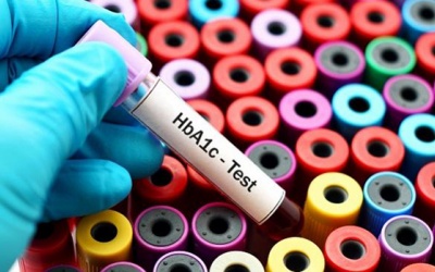 Chỉ số HbA1c là gì và bảng quy đổi các chỉ số đường huyết?