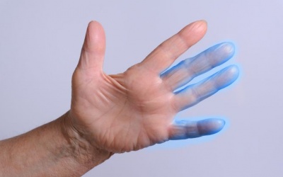 Cảm giác tê bì chân tay là vì đâu?