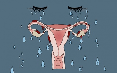 Rối loạn tâm thần tiền kinh nguyệt có thể dẫn tới tự tử