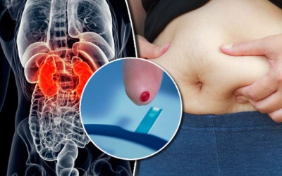 Video: Làm thế nào để xác định nguy cơ mắc đái tháo đường type 2?