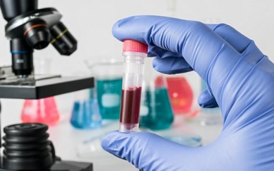 Xét nghiệm máu mang tính đột phá giúp phát hiện sớm u ác tính