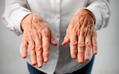 9 dấu hiệu phân biệt biểu hiện run trong bệnh run vô căn và Parkinson