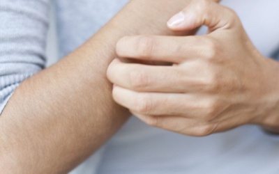 Làm thế nào để ngăn ngừa côn trùng đốt trong mùa Hè?