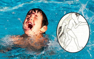 Vác trẻ lên vai chạy làm mất cơ hội sống của trẻ đuối nước!