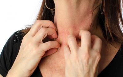 Vẩy phấn hồng là bệnh gì?