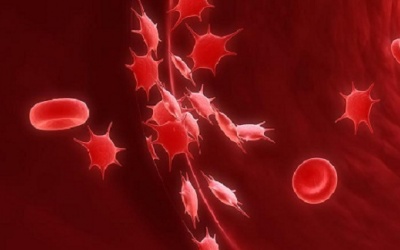 7 thực phẩm tốt nhất để tăng tiểu cầu trong máu