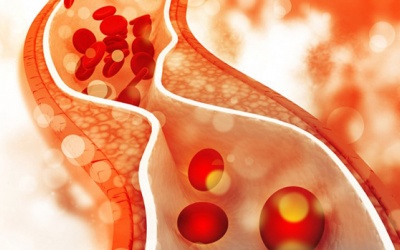 “Giải oan” cho cholesterol: Cholesterol không phải nguyên nhân gây bệnh tim mạch