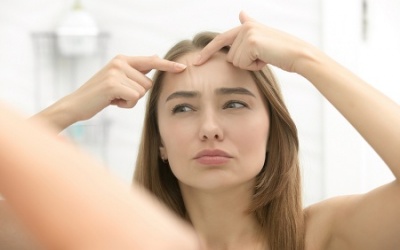 3 điều cần ghi nhớ để đối phó với mụn trứng cá dễ dàng