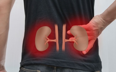 Sỏi tiết niệu: Nguyên nhân, triệu chứng và cách điều trị