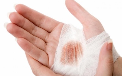 Dùng Subạc có giúp ngừa vết thương nhiễm trùng?